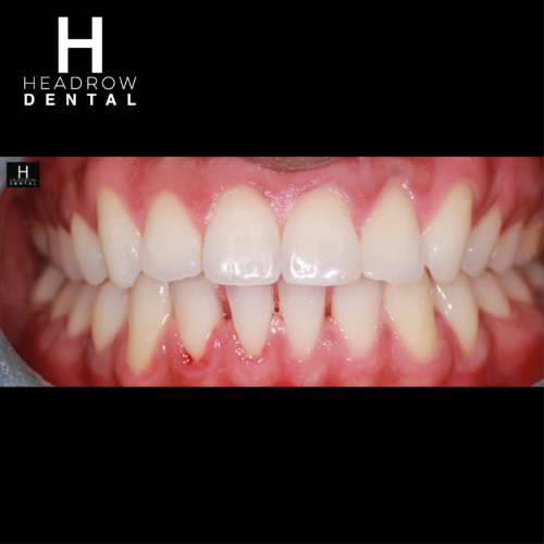 Headrow Dental Web images _ortho cases 1