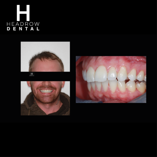 Headrow Dental Web images _ortho cases 2