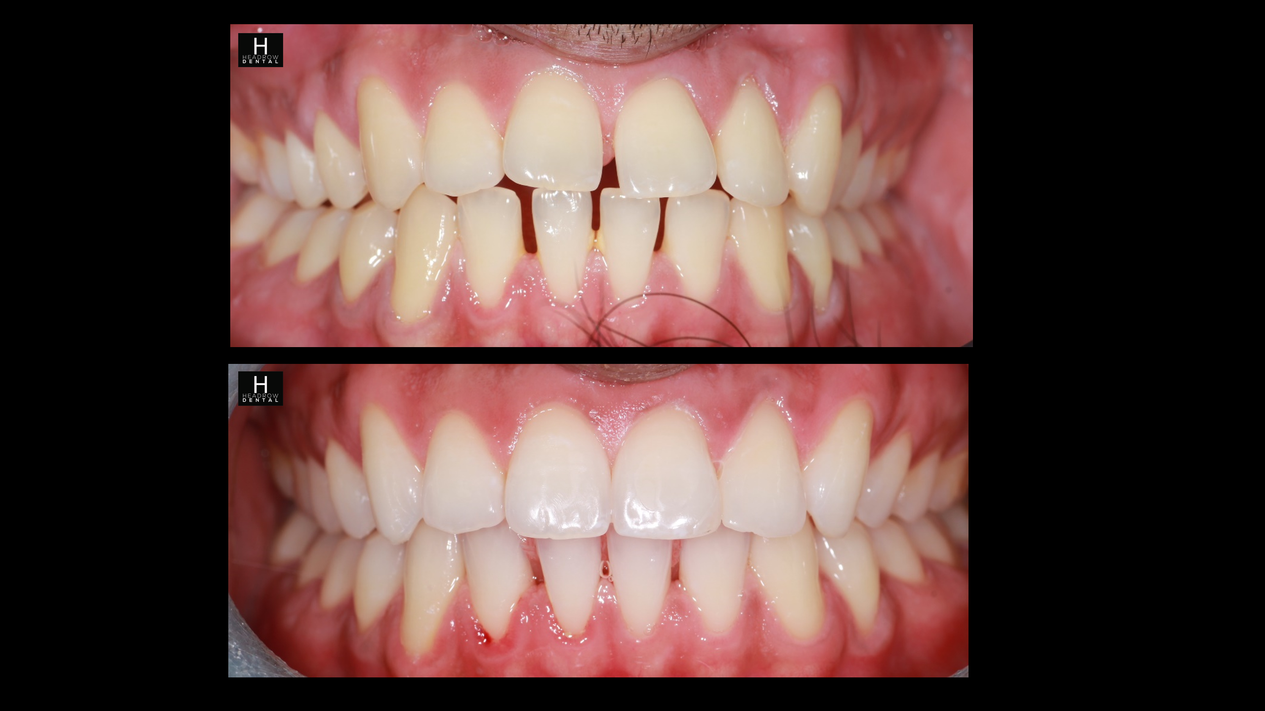 Orthodontics 1 a